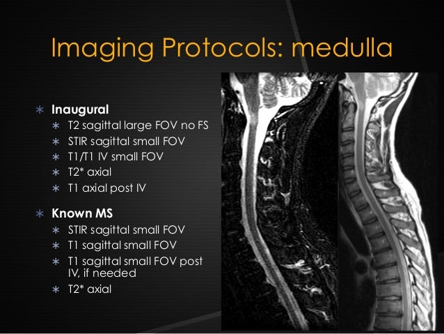 r lavayssiere mri and multiple sclerosis in clinical practice jfim h