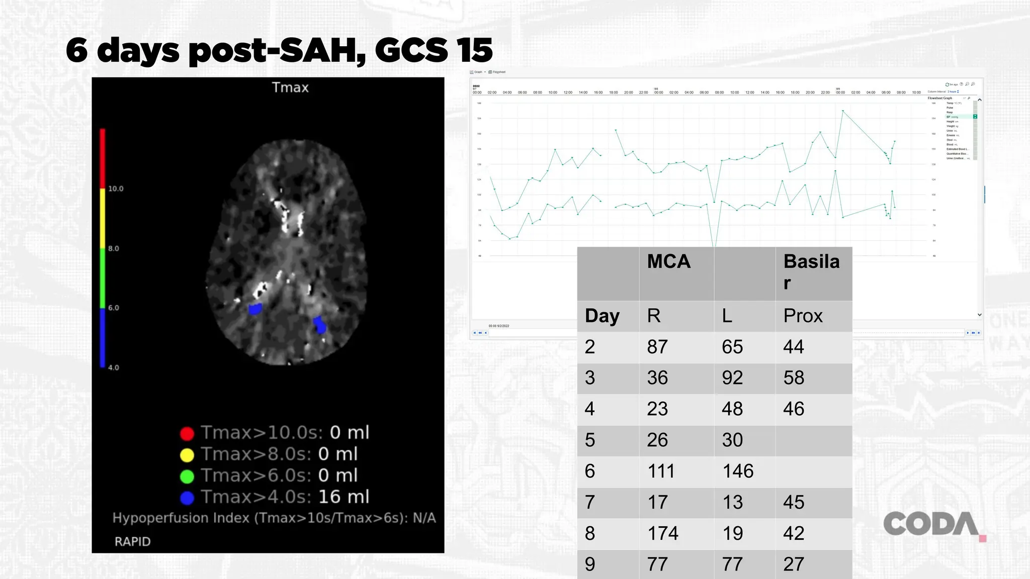 6 days post-SAH, GCS 15
MCA Basila
r
Day R L Prox
2 87 65 44
3 36 92 58
4 23 48 46
5 26 30
6 111 146
7 17 13 45
8 174 19 42
9 77 77 27
 