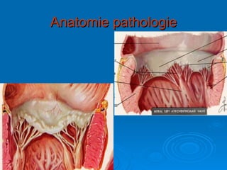 Anatomie pathologie 