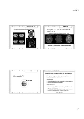 07/09/13	
  
14	
  
O que representam estas imagens?
Imagens de CT
Imagem por RM e o átomo de
Hidrogênio
O que representam as imagens de RM?
Representa o comportamento do átomo de hidrogênio
RMN e H
Átomo de 1H
H 	
  	
  Princípios	
  Físicos	
  em	
  Ressonância	
  Magné>ca	
  
IMIP	
  2009	
  -­‐	
  Vagner	
  Cassola	
  
Imagem	
  por	
  RM	
  e	
  o	
  átomo	
  de	
  Hidrogênio	
  
•  A	
  formação	
  de	
  imagem	
  de	
  RM	
  devesse	
  principalmente	
  as	
  
interações	
  do	
  próton	
  do	
  núcleo	
  do	
  ¹H.	
  
	
  
Mo>vos	
  Jsicos	
  
–  O	
  próton	
  do	
  ¹H	
  apresenta	
  o	
  maior	
  sensibilidade	
  as	
  campos	
  magné>cos;	
  
–  Possui	
  uma	
  abundância	
  natural	
  de	
  99,98%.	
  
	
  
Mo>vos	
  biológicos	
  
–  Aproximadamente,	
  10%	
  da	
  massa	
  corporal	
  é	
  devido	
  ao	
  átomo	
  de	
  ¹H;	
  
–  As	
  imagens	
  só	
  são	
  possíveis	
  para	
  pequenas	
  moléculas	
  que	
  contenham	
  	
  
o	
  ¹H,	
  como	
  é	
  o	
  casos	
  da	
  água;	
  
–  As	
  caracterís>cas	
  de	
  ressonância	
  do	
  ¹H	
  nos	
  tecidos	
  doentes	
  e	
  saudável	
  
geralmente	
  é	
  diferente,	
  porque	
  a	
  quan>dade	
  de	
  água	
  varia	
  
 