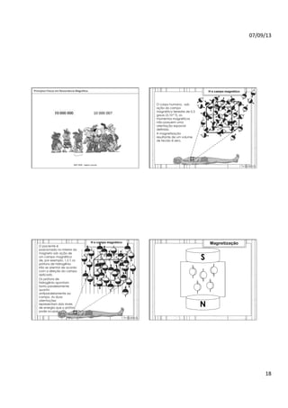07/09/13	
  
18	
  
	
  	
  Princípios	
  Físicos	
  em	
  Ressonância	
  Magné>ca	
  
IMIP	
  2009	
  -­‐	
  Vagner	
  Cassola	
  
007	
  
O corpo humano, sob
ação do campo
magnético terrestre de 0,3
gauss (3.10-5 T), os
momentos magnéticos
não possuem uma
orientação espacial
definida.
1 T=10.000 G
A magnetização
resultante de um volume
de tecido é zero.
H e campo magnético
O paciente é
posicionado no interior do
magneto sob ação de
um campo magnético
de, por exemplo, 1,5 T, os
prótons de hidrogênio
irão se orientar de acordo
com a direção do campo
aplicado.
1 T=10.000 G
Os prótons de
hidrogênio apontam
tanto paralelamente
quanto
antiparalelamente ao
campo. As duas
orientações
representam dois níveis
de energia que o próton
pode ocupar.
H e campo magnético
S
N
Magnetização
 