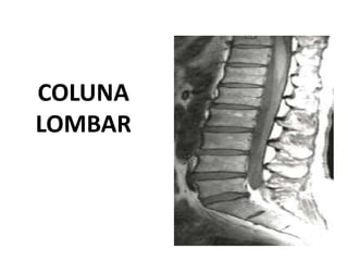 COLUNA
LOMBAR
 