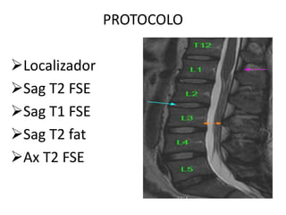 PROTOCOLO
Localizador
Sag T2 FSE
Sag T1 FSE
Sag T2 fat
Ax T2 FSE
 