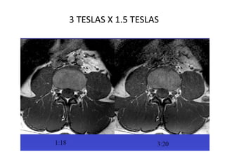 3 TESLAS X 1.5 TESLAS
 