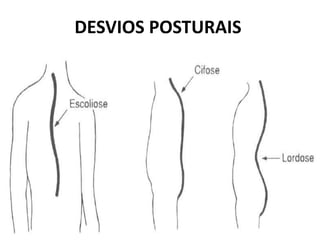 DESVIOS POSTURAIS
 