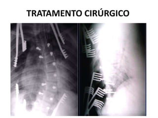 TRATAMENTO CIRÚRGICO
 