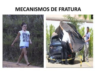 MECANISMOS DE FRATURA
 