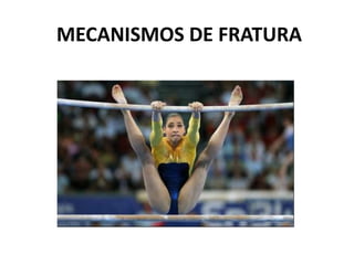 MECANISMOS DE FRATURA
 