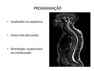 PROGRAMAÇÃO
• Localizador ou sequência.
• Início e fim dos cortes.
• Orientação: caudocranial
ou craniocaudal.
 