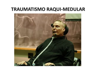 TRAUMATISMO RAQUI-MEDULAR
 