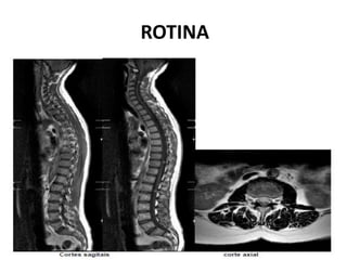 ROTINA
 