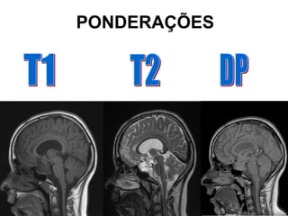 PONDERAÇÕES
 