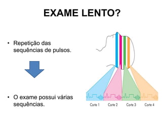 EXAME LENTO?
• Repetição das
sequências de pulsos.
• O exame possui várias
sequências.
 