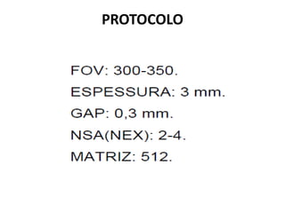 PROTOCOLO
 