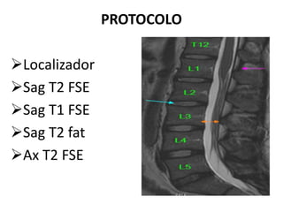 PROTOCOLO
Localizador
Sag T2 FSE
Sag T1 FSE
Sag T2 fat
Ax T2 FSE
 
