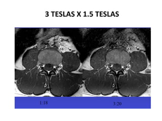 3 TESLAS X 1.5 TESLAS
 