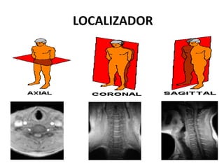 LOCALIZADOR
 