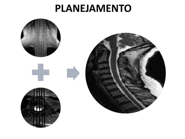 RM COLUNA VERTEBRAL | PDF