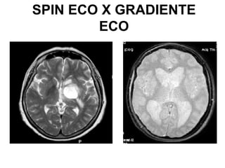 SPIN ECO X GRADIENTE
ECO
 