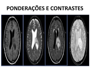 PONDERAÇÕES E CONTRASTES
 