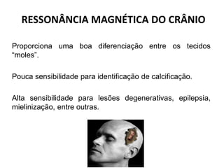 RESSONÂNCIA MAGNÉTICA DO CRÂNIO
Proporciona uma boa diferenciação entre os tecidos
“moles”.
Pouca sensibilidade para identificação de calcificação.
Alta sensibilidade para lesões degenerativas, epilepsia,
mielinização, entre outras.
 
