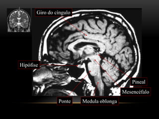 Medula oblongaPonte
Mesencéfalo
Hipófise
Giro do cíngulo
Pineal
 