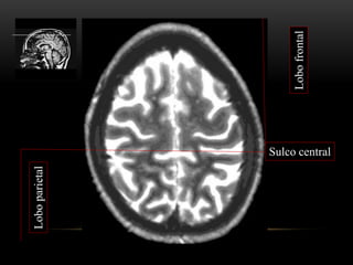 Lobofrontal
Loboparietal
Sulco central
 