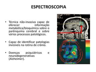 ESPECTROSCOPIA
• Técnica não-invasiva capaz de
oferecer informação
metabólica/bioquímica sobre o
parênquima cerebral e sobre
vários processos patológicos.
• Capaz de identificar patologias
invisíveis na rotina de crânio.
• Doenças psiquiátricas e
neurodegenerativas
(Alzheimer).
 