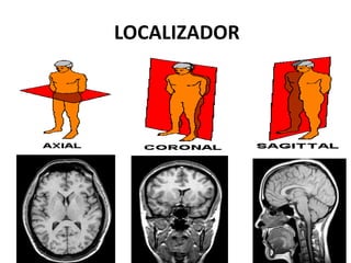 LOCALIZADOR
 