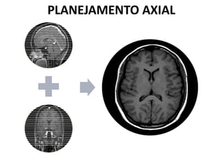 PLANEJAMENTO AXIAL
 