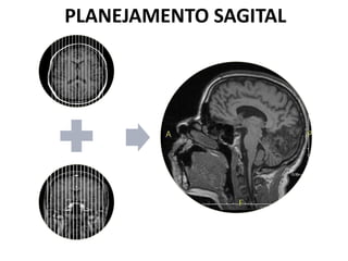PLANEJAMENTO SAGITAL
 