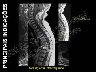 RM da Coluna Vertebral