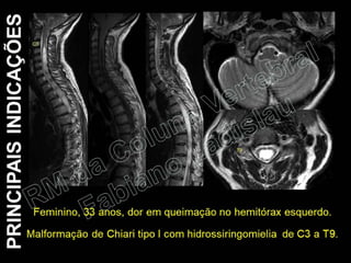 RM da Coluna Vertebral