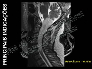 RM da Coluna Vertebral