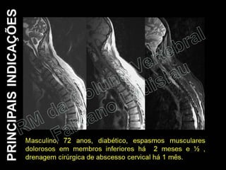 RM da Coluna Vertebral