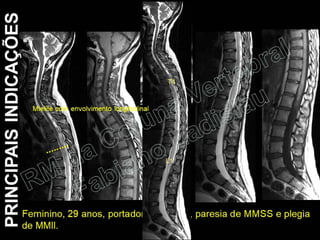RM da Coluna Vertebral