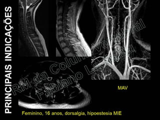 RM da Coluna Vertebral