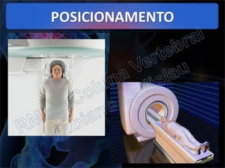 RM da Coluna Vertebral