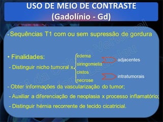 RM da Coluna Vertebral