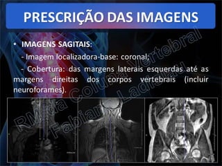 RM da Coluna Vertebral