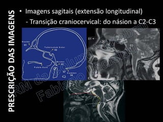 RM da Coluna Vertebral