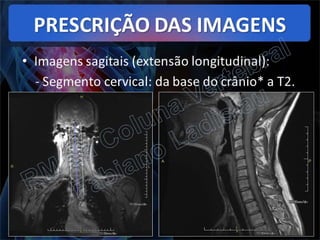 RM da Coluna Vertebral