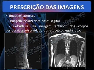 RM da Coluna Vertebral