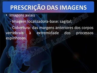RM da Coluna Vertebral