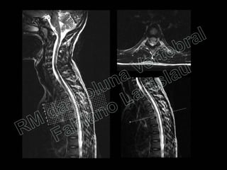 RM da Coluna Vertebral