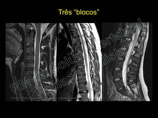 RM da Coluna Vertebral