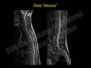 RM da Coluna Vertebral