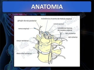 RM da Coluna Vertebral