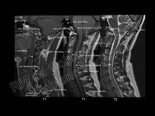 RM da Coluna Vertebral