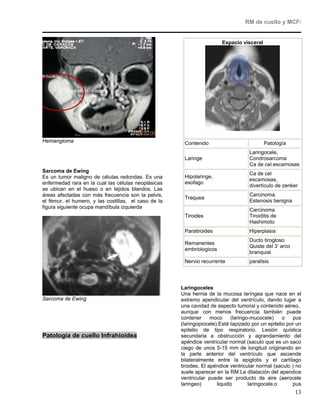 RM de cuello y MCF/


                                                                        Espacio visceral




Hemangioma                                             Contenido                           Patología
                                                                                    Laringocele,
                                                       Laringe                      Condrosarcoma
                                                                                    Ca de cel.escamosas
Sarcoma de Ewing                                                                    Ca de cel
Es un tumor maligno de células redondas. Es una        Hipolaringe,
                                                                                    escamosas,
enfermedad rara en la cual las células neoplásicas     esofago
                                                                                    divertículo de zenker
se ubican en el hueso o en tejidos blandos. Las
áreas afectadas con más frecuencia son la pelvis,                                   Carcinoma.
                                                       Traquea
el fémur, el humero, y las costillas, el caso de la                                 Estenosis benigna
figura siguiente ocupa mandíbula izquierda
                                                                                    Carcinoma
                                                       Tiroides                     Tiroiditis de
                                                                                    Hashimoto
                                                       Paratiroides                 Hiperplasia
                                                                                    Ducto tirogloso
                                                       Remanentes
                                                                                    Quiste del 3’ arco
                                                       embriologicos
                                                                                    branquial
                                                       Nervio recurrente            paralisis




                                                      Laringoceles
                                                      Una hernia de la mucosa laríngea que nace en el
Sarcoma de Ewing                                      extremo apendicular del ventrículo, dando lugar a
                                                      una cavidad de aspecto tumoral y contenido aéreo,
                                                      aunque con menos frecuencia también puede
                                                      contener      moco    (laringo-mucocele)     o   pus
                                                      (laringopiocele).Está tapizado por un epitelio por un
                                                      epitelio de tipo respiratorio. Lesión quística
Patología de cuello Infrahioidea                      secundaria a obstrucción y agrandamiento del
                                                      apéndice ventricular normal (saculo que es un saco
                                                      ciego de unos 5-15 mm de longitud originando en
                                                      la parte anterior del ventrículo que asciende
                                                      bilateralmente entre la epiglotis y el cartílago
                                                      tiroides. El apéndice ventricular normal (saculo ) no
                                                      suele aparecer en la RM.La dilatación del apendice
                                                      ventricular puede ser producto de aire (aerocele
                                                      laringeo)       liquido       laringocele,o      pus
                                                                                                         13
 